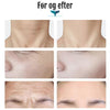 EMS enhed med LED lys til hudfornyelse og anti aging behandling