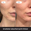 Anti pickel patches der reducerer urenheder over tid