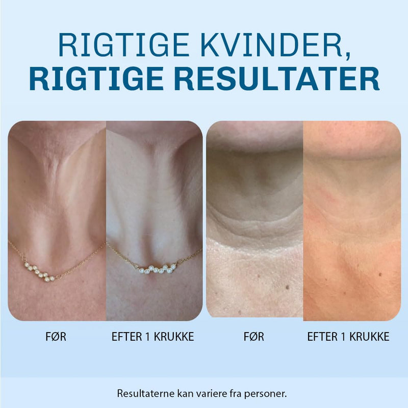 Creme til hals der forbedrer elasticitet og hudens struktur
