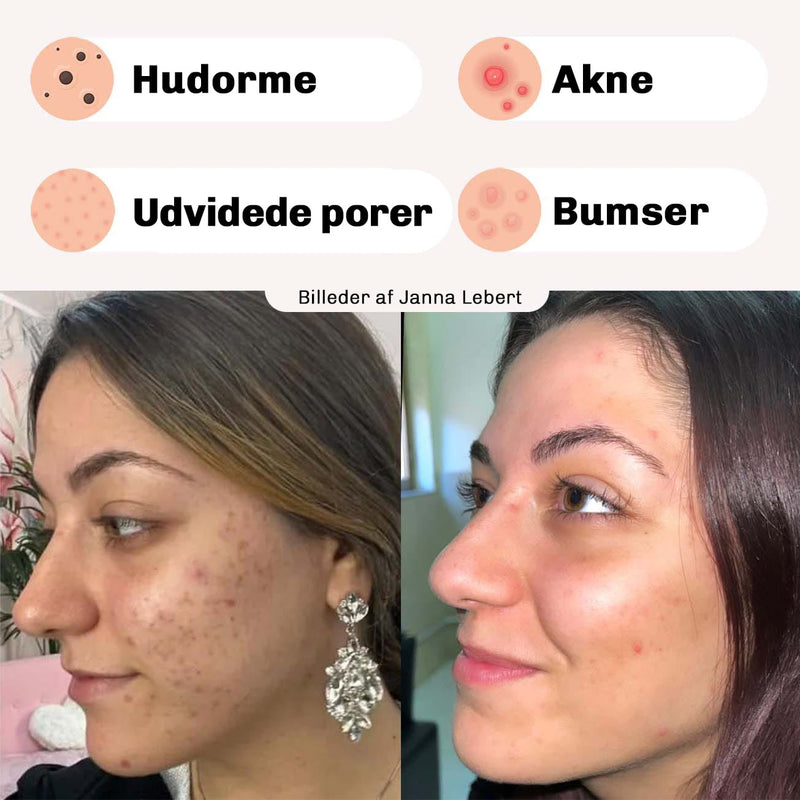 Skansom peel off maske til sensitiv hud med effektiv rens