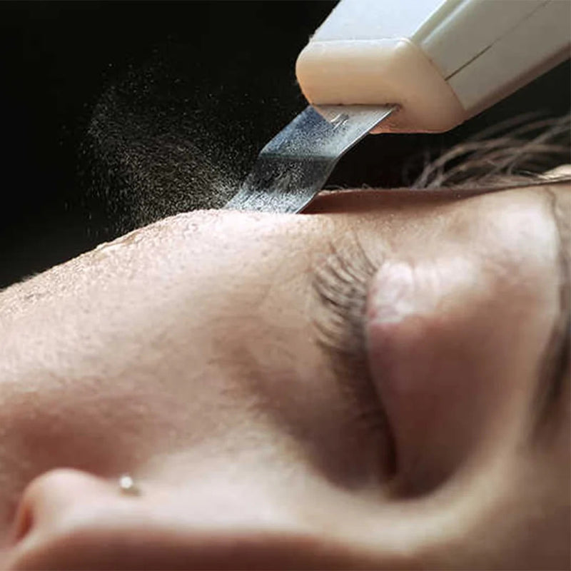 Skånsom ultralyd peeling til sensitiv hud uden irritation