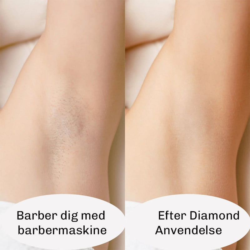IPL hårfjerner til ben arme ansigt og bikinilinje