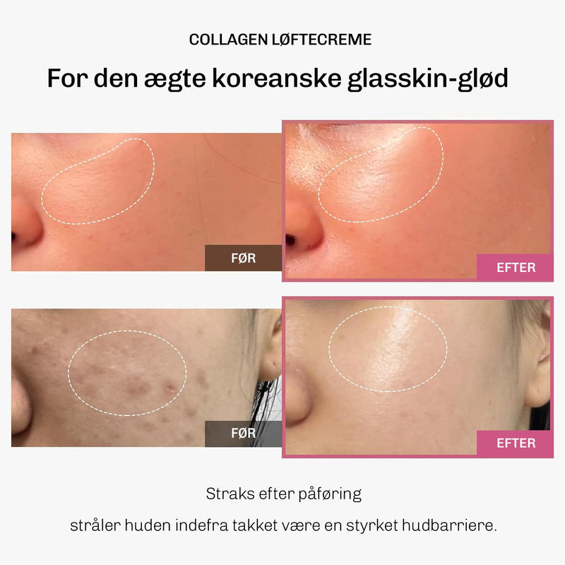 Lifting creme med kollagen der forbedrer elasticitet og giver fyldigere hud