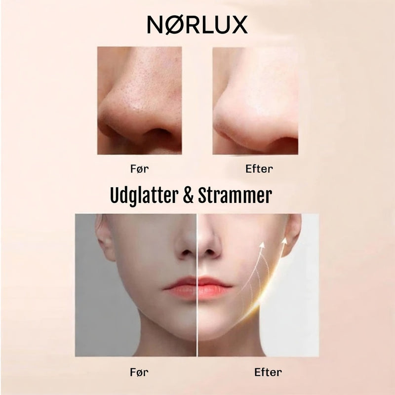 Ultralyd peeling til hjemmebrug med professionel effekt